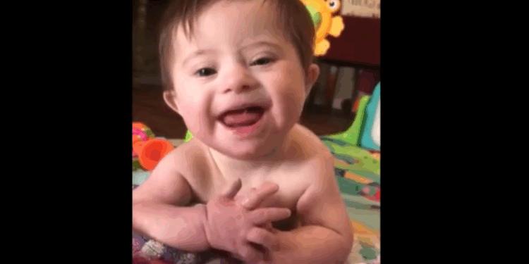 There is No Defense for Killing Babies With Down Syndrome in Abortions