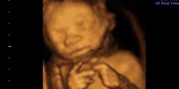 UK Killed Almost 300,000 Babies in Abortions in 2023