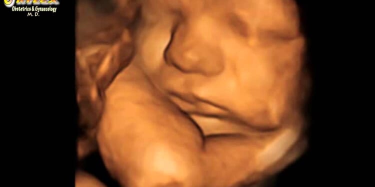 Why Does Trump Blow Up Boats to Stop Deadly Drugs, But Won’t Save Babies From Abortion Drugs?