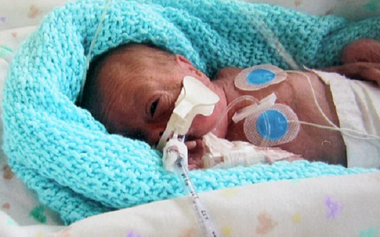 108 Babies in Ireland Were Born Alive After Botched Abortions