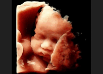 Without Pro-Life Laws Saving Babies, Nevada Abortions Increase Almost 7%
