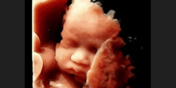 Without Pro-Life Laws Saving Babies, Nevada Abortions Increase Almost 7%