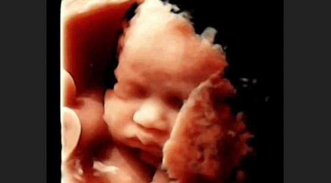 Without Pro-Life Laws Saving Babies, Nevada Abortions Increase Almost 7%