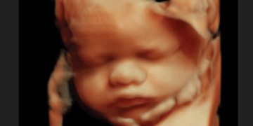 Biden Policy is Killing Over 500 Babies a Day in Abortions. But Trump Could End It