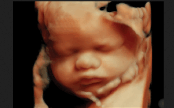 Biden Policy is Killing Over 500 Babies a Day in Abortions. But Trump Could End It