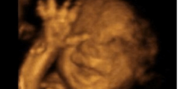 Minnesota Senate Committee OKs Measure for Right to Kill Babies in Abortions