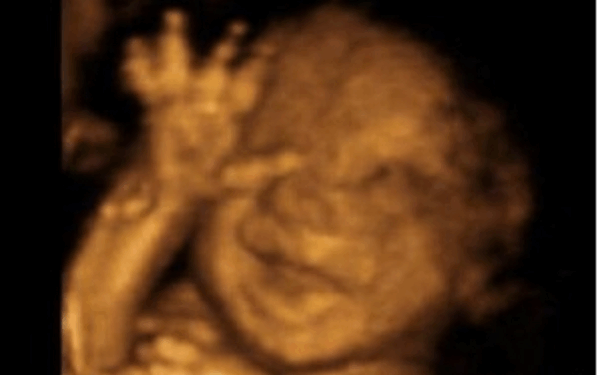 Minnesota Senate Committee OKs Measure for Right to Kill Babies in Abortions