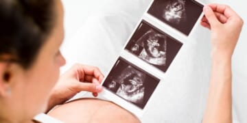 No States With Abortion Bans Prevent Miscarriage Treatment