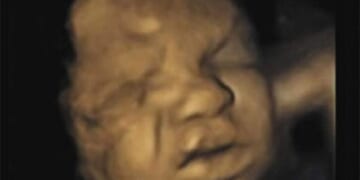 Ohio Court Blocks Law to Stop Dumping Aborted Babies in Landfills