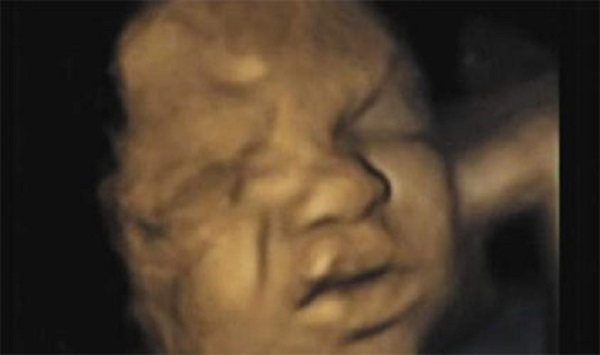 Ohio Court Blocks Law to Stop Dumping Aborted Babies in Landfills