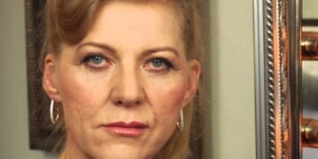 Woman is Euthanized and Her Face Transplanted