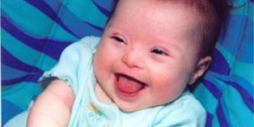 11,000 Babies Killed in Ireland in 2024, 208 Just Because They Had Down Syndrome