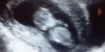 Arizona Bill Would Stop Mail-Order Abortions