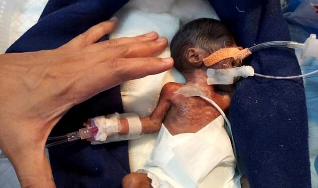 Democrats in Oregon Vote for Infanticide a Second Time