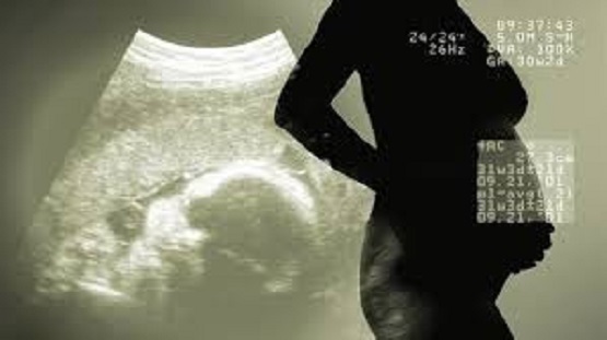 Kentucky Democrat Wants a Right to Kill Babies in Abortions