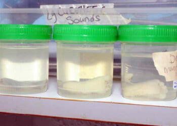 Kermit Gosnell Was So Brutally Evil He Kept Aborted Baby Feet as Souvenirs