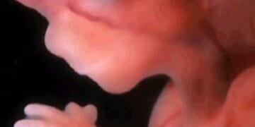 Quebec Won’t Say Killing Babies in Abortions is a Constitutional Right