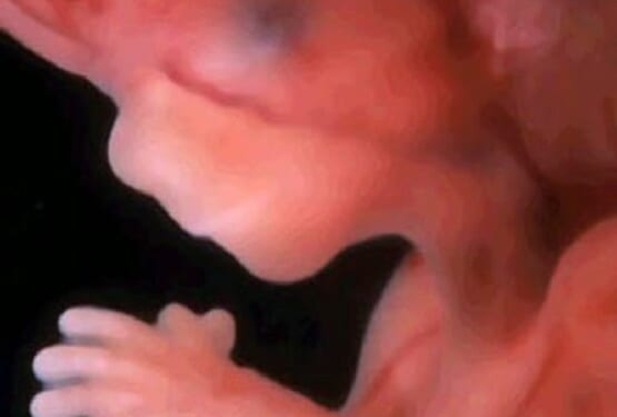 Quebec Won’t Say Killing Babies in Abortions is a Constitutional Right