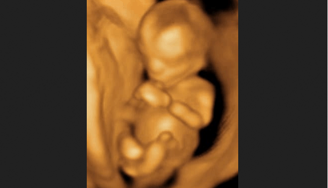 South Dakota Legislature Passes Multiple Pro-Life Bills