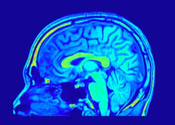 The Human Brain is Better Than Artificial Ones