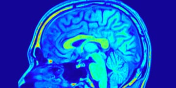 The Human Brain is Better Than Artificial Ones