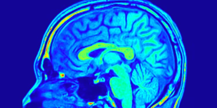 The Human Brain is Better Than Artificial Ones