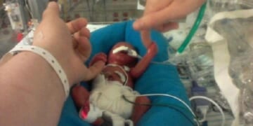 17 Babies Who Survived Abortions in Alberta Were Left to Die