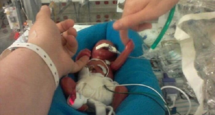 17 Babies Who Survived Abortions in Alberta Were Left to Die