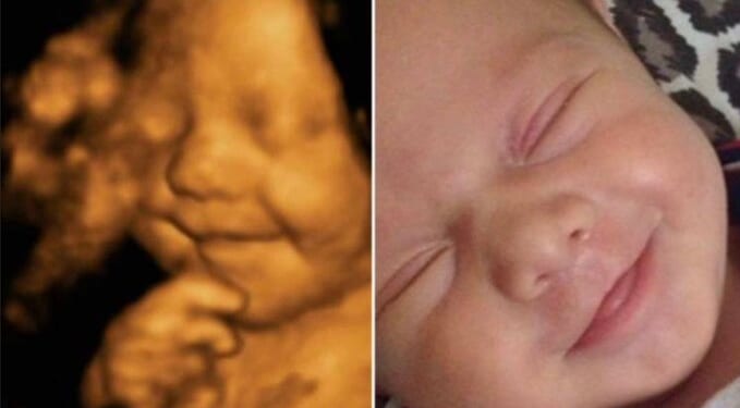 Abortion is Wrong Because Unborn Babies are Human Beings