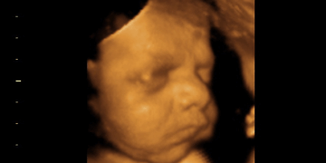 Aborton Activists Claim an Unborn Baby is Merely a ‘Gestator’s’ Body Part