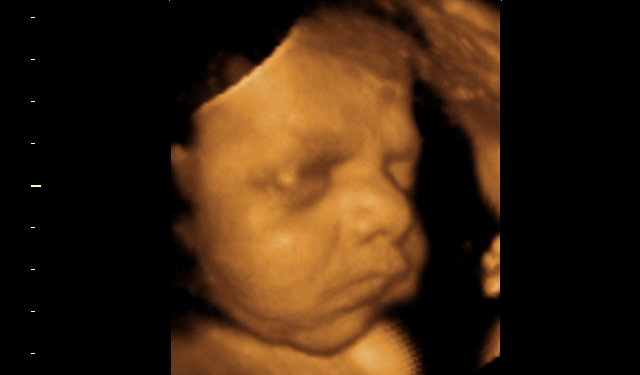 Aborton Activists Claim an Unborn Baby is Merely a ‘Gestator’s’ Body Part