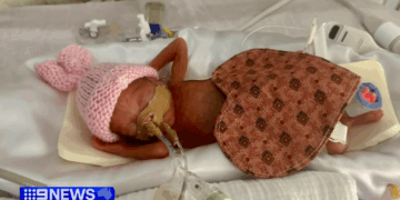 Australia’s Most Premature Baby Ever Was Born at 22 Weeks