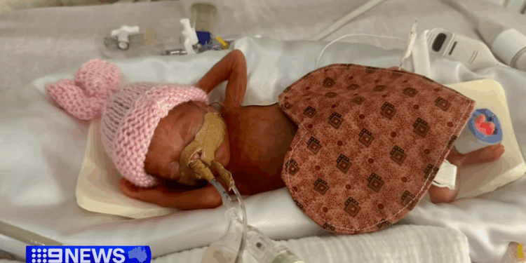 Australia’s Most Premature Baby Ever Was Born at 22 Weeks