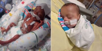 Baby Born at 23 Weeks Was the Size of a Water Bottle