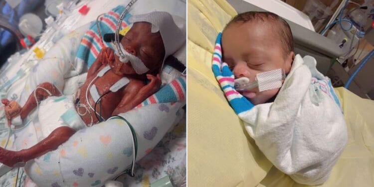 Baby Born at 23 Weeks Was the Size of a Water Bottle