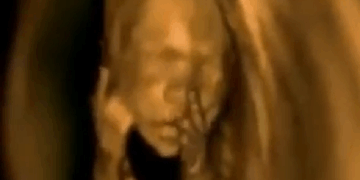 British Centers Will Start Selling “Lunch-Hour Abortions.” Kill Your Baby and Go Back to Work