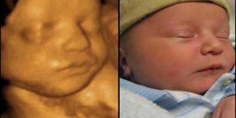 Mississippi Banned Mail-Order Abortions. Other States Should Follow Suit