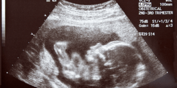 Mississippi Governor Signs Bill to Ban Mail-Order Abortions