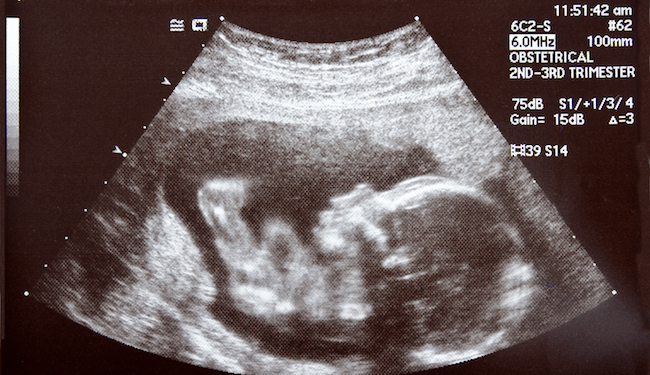 Mississippi Governor Signs Bill to Ban Mail-Order Abortions