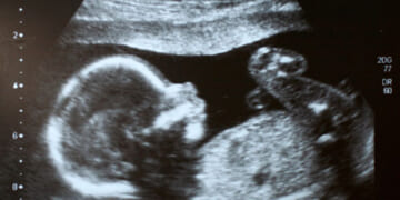 Mississippi Legislature Passes Bill Banning Mail-Order Abortions