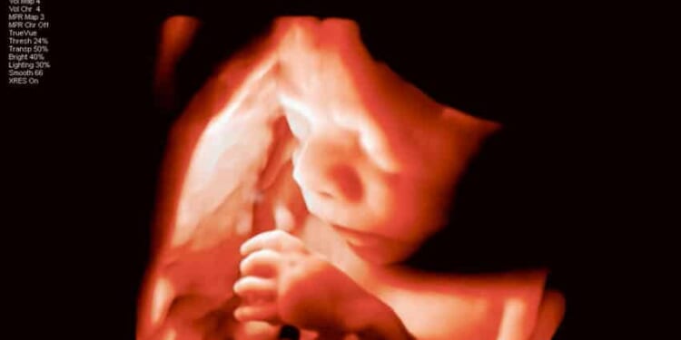 Pennsylvania Court Forces Taxpayers to Fund Abortions
