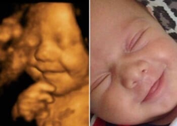 Senate Will Investigate Dangerous Abortion Pills Killing Babies and Hurting Women