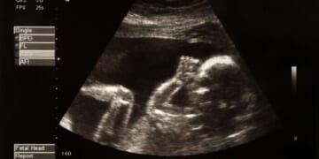 Wyoming Judge Blocks Heartbeat Law Saving Babies From Abortions