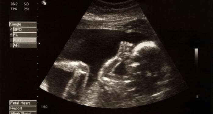 Wyoming Judge Blocks Heartbeat Law Saving Babies From Abortions