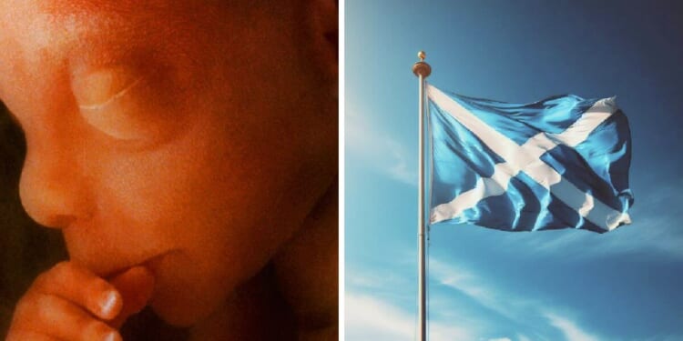 18,783 Babies Were Killed in Abortions in Scotland Last Year, a Record High
