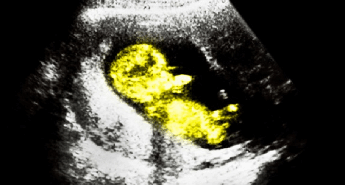 Pro-Life Group Supports Louisiana’s Bid to Stop Mail-Order Abortions