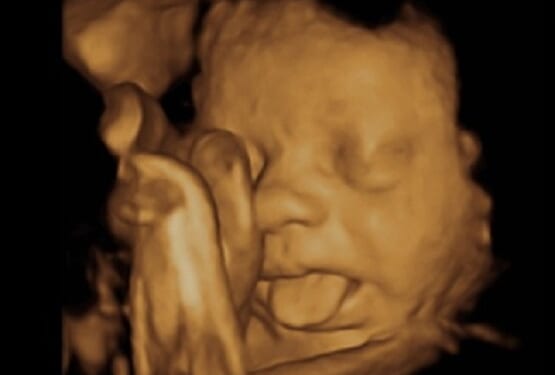 Pro-Life Group Wants Federal Law Enforced to Stop Mail-Order Abortions