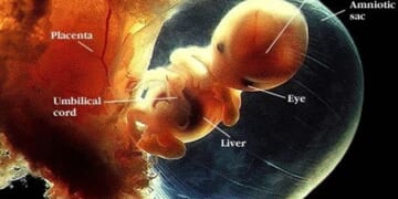 Unborn Babies Can’t be a Clump of Cells When They Have a Heartbeat