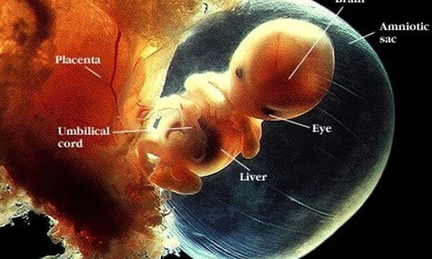 Unborn Babies Can’t be a Clump of Cells When They Have a Heartbeat