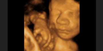1,121,450 Babies Were Killed in Abortions in America in One Year